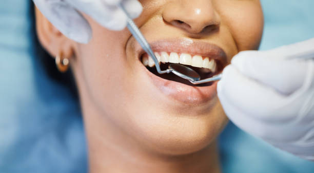 Best Emergency Dentist for Lost Fillings or Crowns in Walsenburg, CO